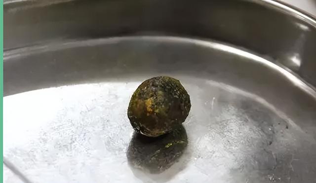 不想长胆结石，切记这6类食物要少吃！胆结石患者尤其需要注意