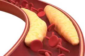 脑梗患者吃什么好？多吃这4种食物，让身体恢复得更快图片