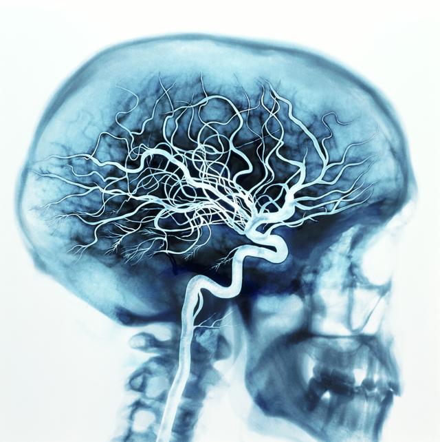 人“死后”会经历怎样的过程？科学家：“生前”的这个指标很关键