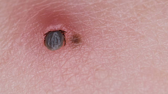 6种常见蚊虫咬伤的症状，怎么预防和治疗？一次给你讲清楚