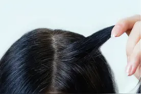 科学补充4种维生素，改善毛发代谢，促进黑色素形成，防治白头发图片