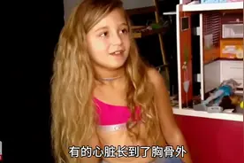 世界上与众不同的十个小孩#奇特小孩图片