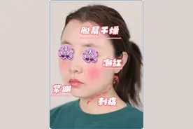 一到换季，就起皮、干痒、泛红？做到这几点，敏感其实很好解决！图片