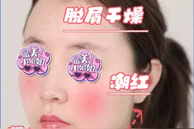 一到换季，就起皮、干痒、泛红？做到这几点，敏感其实很好解决！图片