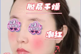 一到换季，就起皮、干痒、泛红？做到这几点，敏感其实很好解决！图片
