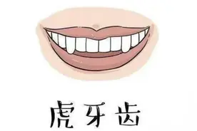 虎牙到底能不能拔掉，你知道么?图片