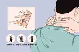 颈背疼痛、手麻：5张图快速判断自己是哪种颈椎病图片