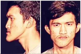 为爱整容，从面貌丑陋变成帅气小鲜肉：这才是整容存在的意义图片