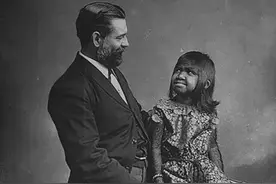 141年前，“野人女孩”被探险队抓走供人观赏，临终遗言令人心酸图片