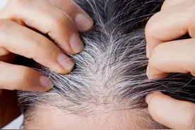 关于正确染发的小妙招，可减少染发品对皮肤的刺激图片