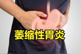 查出萎缩性胃炎，竟是一个好事？听杜主任讲完，道理很简单图片