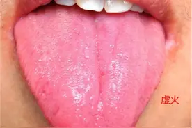 舌头红、厚、凹、凸都是病！舌红有热 舌厚有痰 舌凹有虚，舌鼓有堵图片