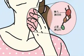 颌下淋巴结经常肿大和疼痛的原因是什么？图片