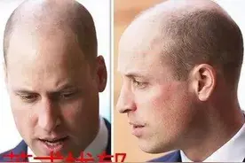 早期英国男人戴假发背后的原因，你知道多少图片