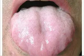 胃痛，吃凉的就拉肚子？脾胃虚寒，中医教你两招，学会不走弯路图片