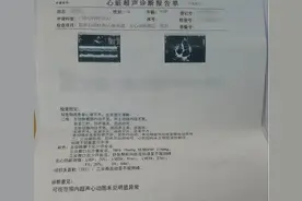 30岁女性竟反复心慌？调整药物剂量助其缓解心律失常图片