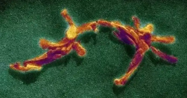 鐑圭叜閮芥潃涓嶆鐨勬湂鐥呮瘨锛岃嚧姝荤巼100%鏃犺嵂鍙晳锛佹劅鏌撳悗鏈夊鎭愭€栵紵