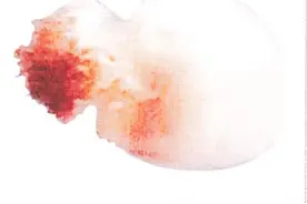 海蜇软萌还好吃？被它蜇伤可就惨了，严重可致命！图片