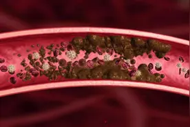 这7个中成药，不仅能够治疗脑卒中，还能清除血管垃圾图片