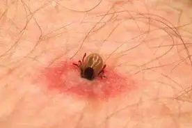 野外露营要注意这种小虫子，从户外回来后，需尽快洗澡和更换衣服图片