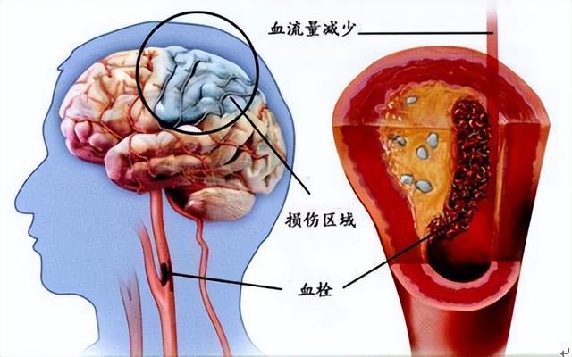 头晕是怎么回事  