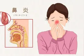 孩子总是鼻塞、流鼻涕？别是得了过敏性鼻炎！医生教你治疗和预防图片
