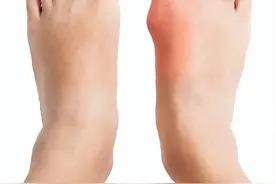 脚上若有3种“异常”，可能是癌细胞到来的“前兆”，早知道早好图片