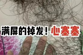 脱发必看！过来人分享三个防脱养发好物别错过！头发蹭蹭往出冒！图片