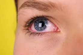 48小时不眨眼会怎样？70岁印度老人，竟然能直视太阳86分钟？图片