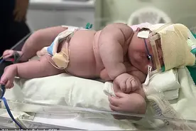 巴西女子产下巨婴，7.3公斤体长59厘米，出生直接穿1岁娃的衣服图片