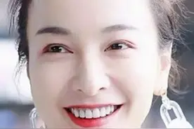 5位烤瓷牙明星，有的牙龈变灰，有的嘴包不住牙，一个比一个惨图片