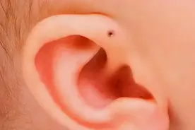 耳朵上会有“聪明孔”的人，真的智商超群吗？图片