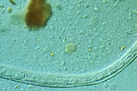 虫子在他皮肤下滑行，肉眼可见：这病有生命危险图片