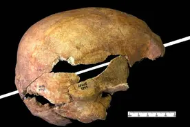 从解剖学的角度来说，椰子硬和人类的头颅，究竟谁更硬？图片