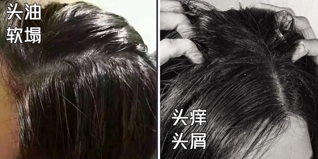 娲楀彂姘粹€滅櫧鍚嶅崟鈥濓細婊″┓閫傚悎澶忓锛岃垝钑句篃涓嶉敊锛岀櫨闆€缇氬ソ鐢ㄨ繕渚垮疁