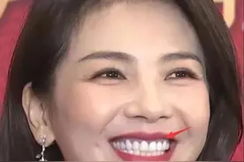 明星“烤瓷牙”有多可怕？嘴凸显老，嘴包不住牙，演戏都没法看了图片