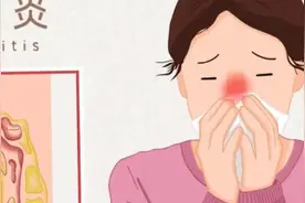 各种鼻炎，流泪，打喷嚏，分享1个中成药，解决鼻炎的烦恼图片