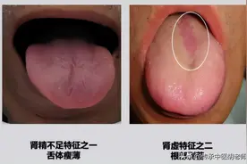 人到中年，“肾”不得已，三个中成药，分清阴阳，益精填髓图片
