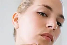 下巴反复爆痘还是偶尔爆痘，速查这4个原因图片