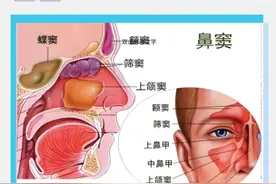 10个必知的鼻窦炎真相！别等鼻塞、头疼才后悔！图片