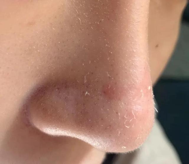 实测九款洗面奶：旁氏便宜但爆痘过敏！两款国货洁面值得入手