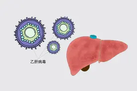 乙肝病毒自然寿命可达36-55年，不进行抗病毒治疗，结果会如何？图片