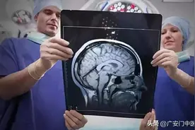 脑瘤是怎样形成的，手术治疗的成功率如何，术后又该怎样护理？图片