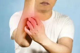 6个奇效止痒中成药，横扫皮肤瘙痒、湿疹、皮炎、荨麻疹等皮肤病图片