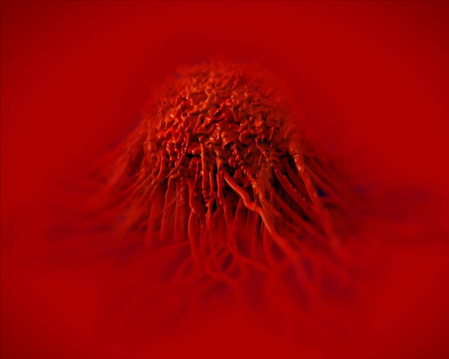 打激光后会角化过度吗