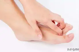 脚气又臭又痒忍不了！脱鞋还尴尬！学会这些，摆脱烦恼超实用图片