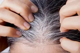 头发早白，脱发，牙齿松动，腰膝酸软，肾精不足早衰，送你一方。图片