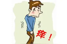 阴囊痒脱皮掉皮屑有红斑图片