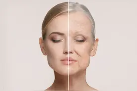 皮肤的5个表现证明你开始衰老？专家教你如何抗衰老图片