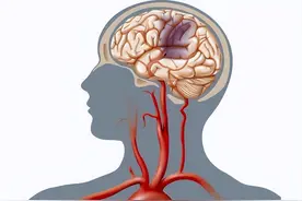 脑梗发生前7-30天，身体或会发出“警告信号”，请别视而不见图片